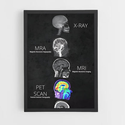 ap-brain anatomy-2 cadre Noir