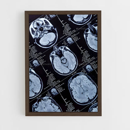 ap-brain scan-1 cadre Bois foncé