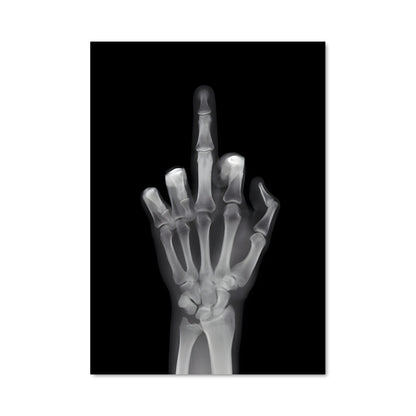 Poster Fracture de l'Attitude