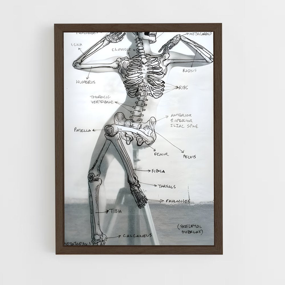 ap-skeleton-3 cadre Bois foncé