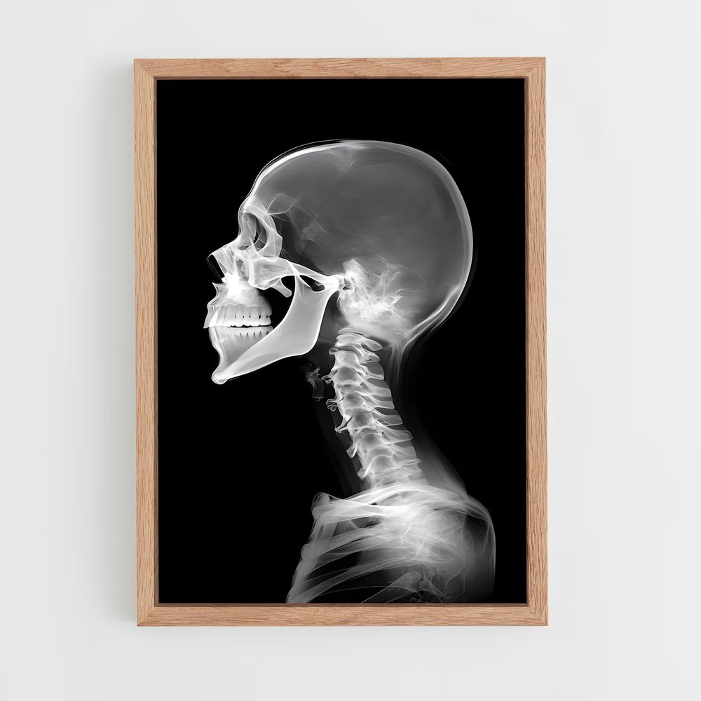 ap-x-rays-1 cadre Bois clair