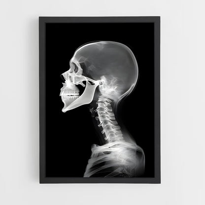 ap-x-rays-1 cadre Noir